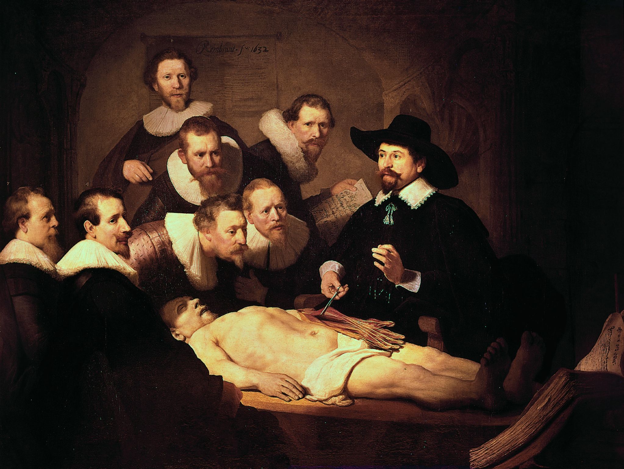 une dissection (la Leçon d’anatomie, tableau de Rembrandt, 1632)