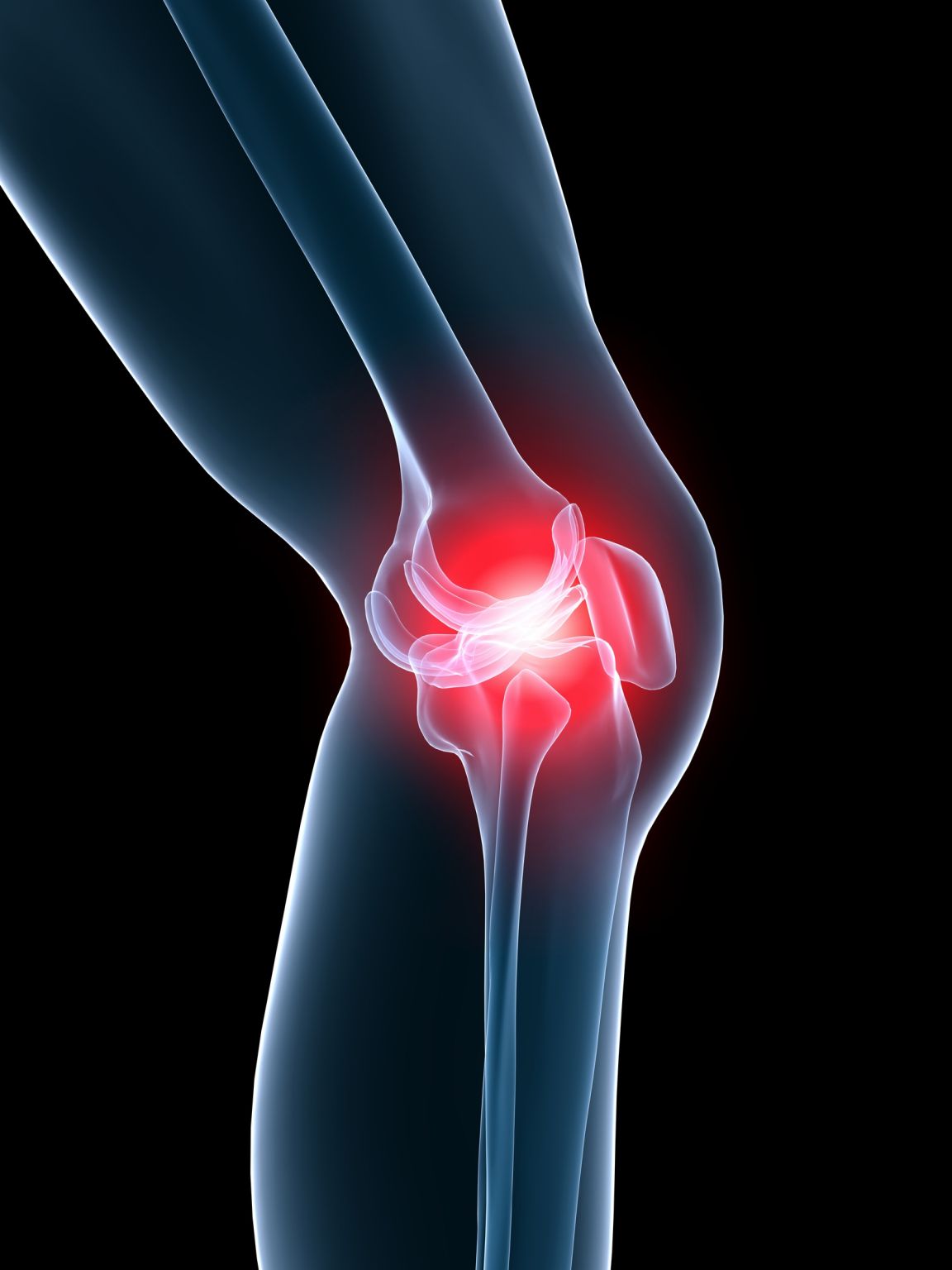 Les rhumatismes rendent les articulations, comme celle du genou, douloureuses.