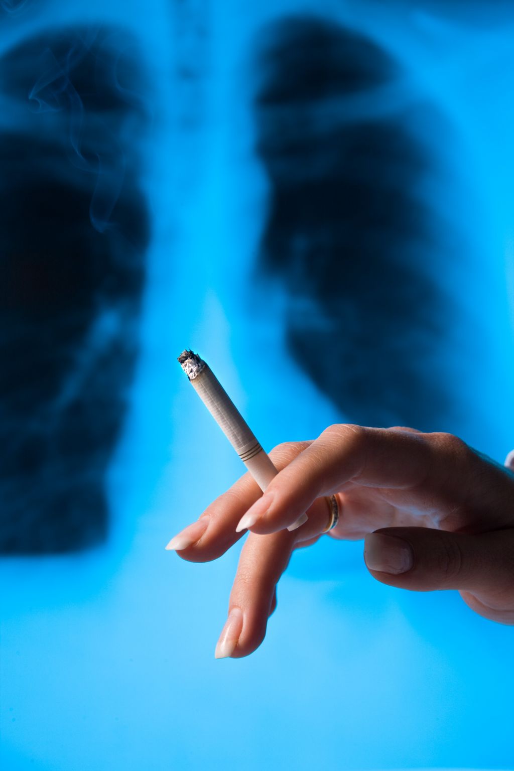 Le tabagisme a des conséquences graves sur la santé, en particulier sur les fonctions respiratoires.